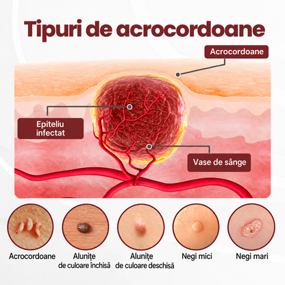🌿👨‍⚕️Biancat® KeraErase Cremă cu Dublă Acțiune pentru Reînnoirea Pielii