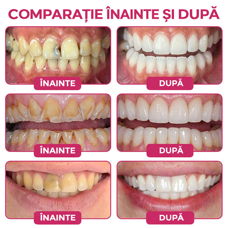 🍏🦷𝑹𝒐𝒍𝒊𝒎𝒆𝒚® 𝑫𝒆𝒏𝑷𝒆𝒓𝒎 𝑮𝒆𝒍 𝑵𝒂𝒕𝒖𝒓𝒂𝒍 𝒑𝒆𝒏𝒕𝒓𝒖 𝑹𝒆𝒑𝒂𝒓𝒂𝒓𝒆𝒂 𝑪𝒂𝒓𝒊𝒊𝒍𝒐𝒓 ș𝒊 𝑹𝒆𝒇𝒂𝒄𝒆𝒓𝒆𝒂 𝑺𝒎𝒂𝒍ț𝒖𝒍𝒖𝒊